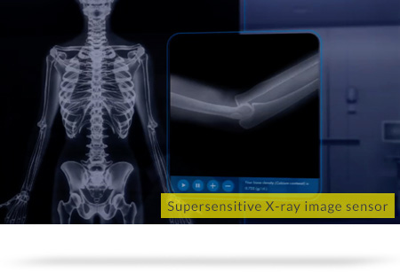 Supersensitive X-ray image sensor